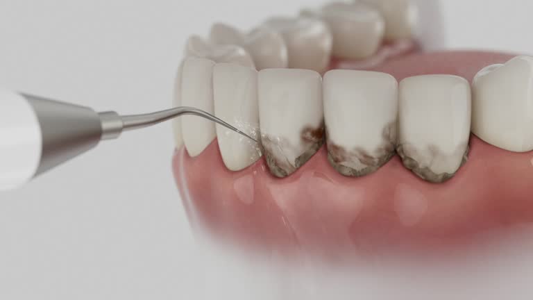 Trusted Tooth Extraction service in Point Baker, FL - Dentist Open Now